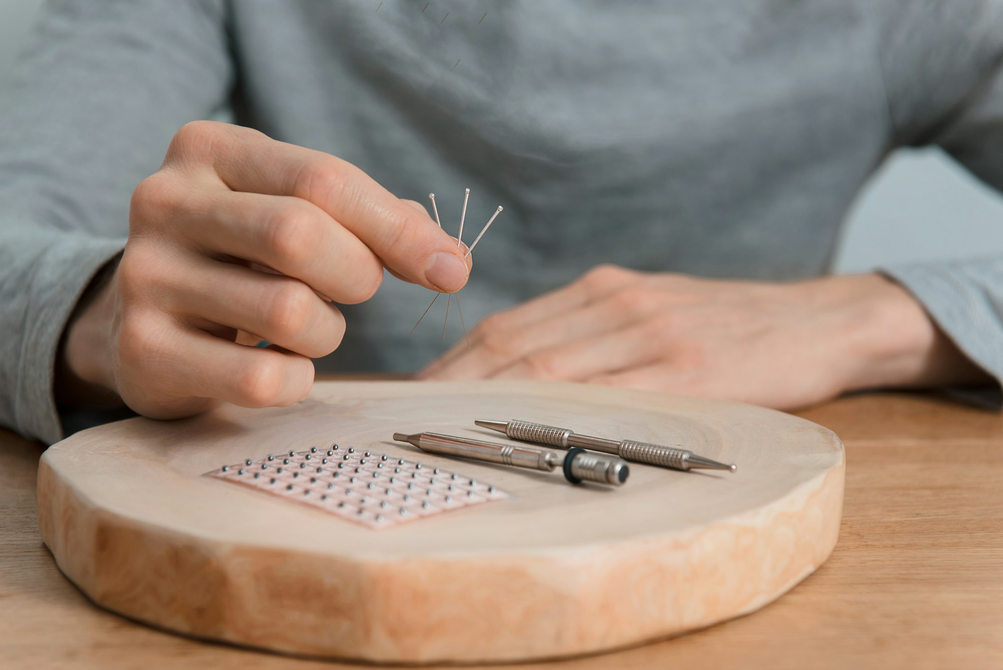 Acupuncture treatment on man's hands, needles.